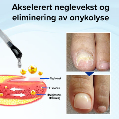 OnyxoGuard Serum for vekst og reparasjon av negler